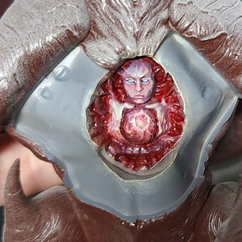 19 Mar 25: Chest Cavity Complete